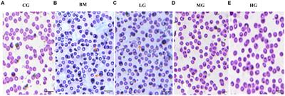 Unrevealing the therapeutic potential of artesunate against emerging zoonotic Babesia microti infection in the murine model